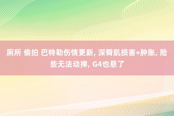 厕所 偷拍 巴特勒伤情更新, 深臀肌损害+肿胀, 险些无法动掸, G4也悬了